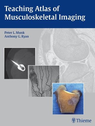 Read Online Teaching Atlas of Musculoskeletal Imaging (Teaching Atlas Series) - Peter L. Munk file in ePub