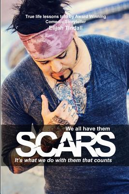 Read Online Scars: We all have them, it's what we do with them that counts - Elijah Tindall file in PDF