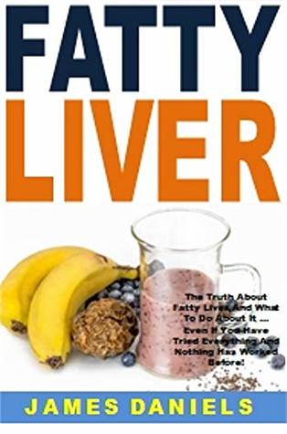 Read Fatty Liver: The Truth About Fatty Liver And What To Do About It  Even If You Have Tried Everything And Nothing Has Worked Before! - James Daniels file in ePub
