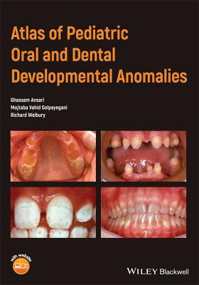 Read Atlas of Pediatric Oral and Dental Developmental Anomalies - Ghassem Ansari file in PDF