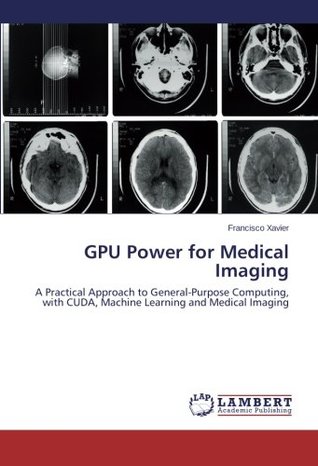 Read Online GPU Power for Medical Imaging: A Practical Approach to General-Purpose Computing, with CUDA, Machine Learning and Medical Imaging - Francisco Xavier file in PDF